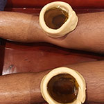Januvasti Specialized ayurvedic treatment to relieve the knee pain